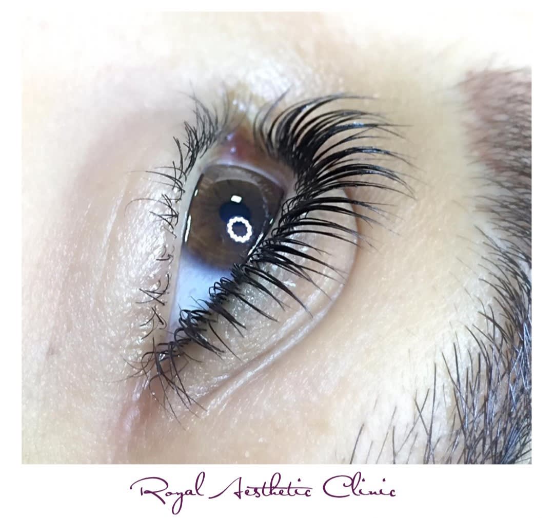 Royal Aesthetic Clinic