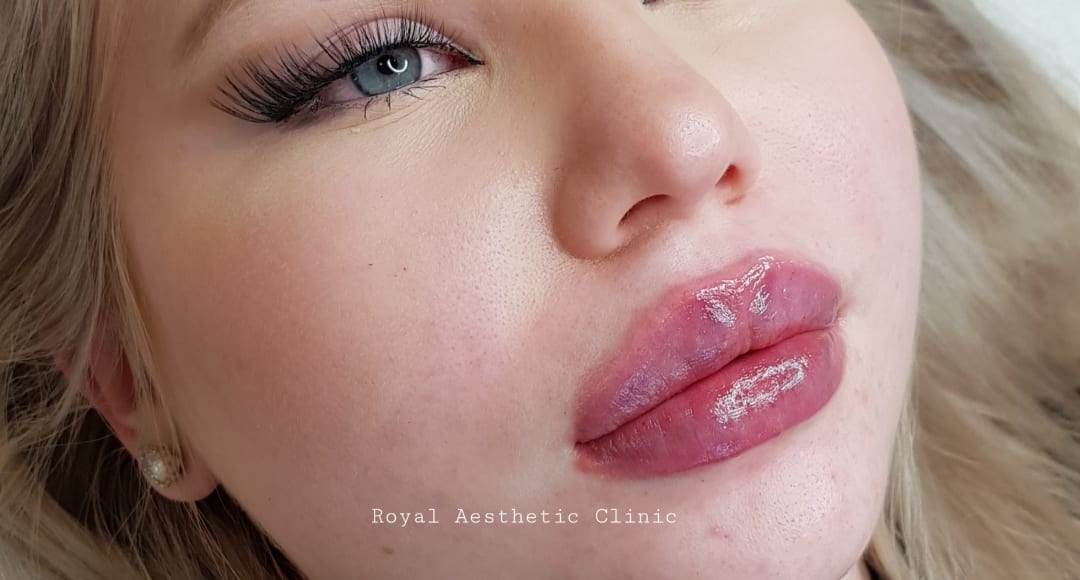 Royal Aesthetic Clinic