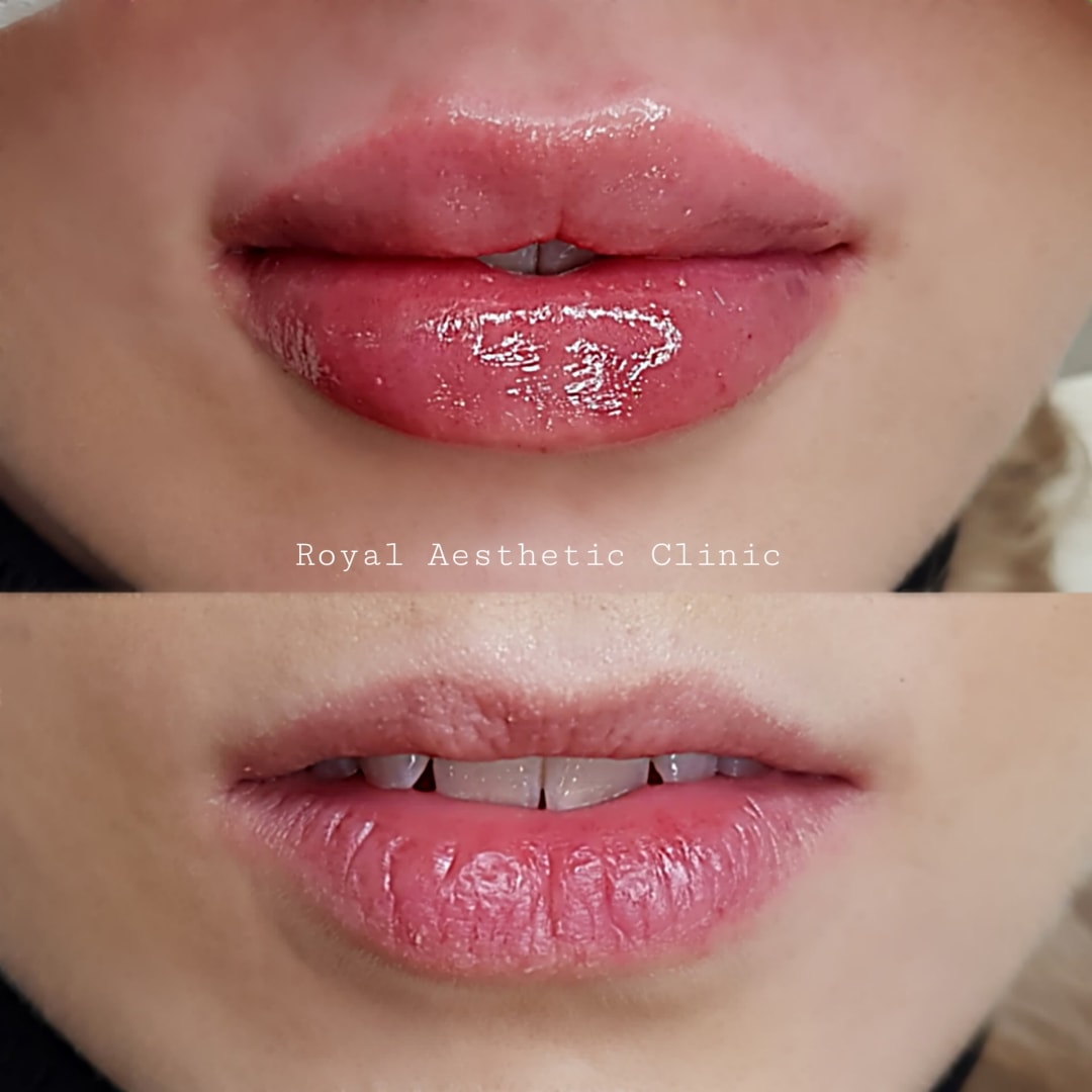 Royal Aesthetic Clinic